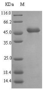 Recombinant Pseudomonas aeruginosa Elastase (lasB) - 1 mg