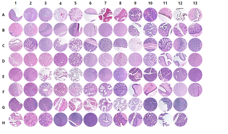 Normal human tissues, FDA, 35 organs in triplicates (1.5mm)