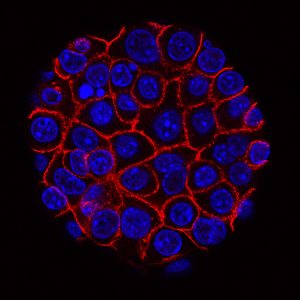 [0870-ABC-TC1175] SUIT-2 cell line - 1 vial